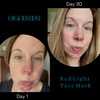 Before and after photos of Lisa Kennedy who underwent red light therapy for hyperpigmentation